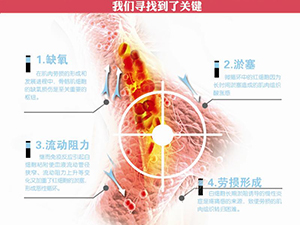 只需一分鐘，肩頸很輕松！——恒怡運(yùn)動(dòng)是有效的
